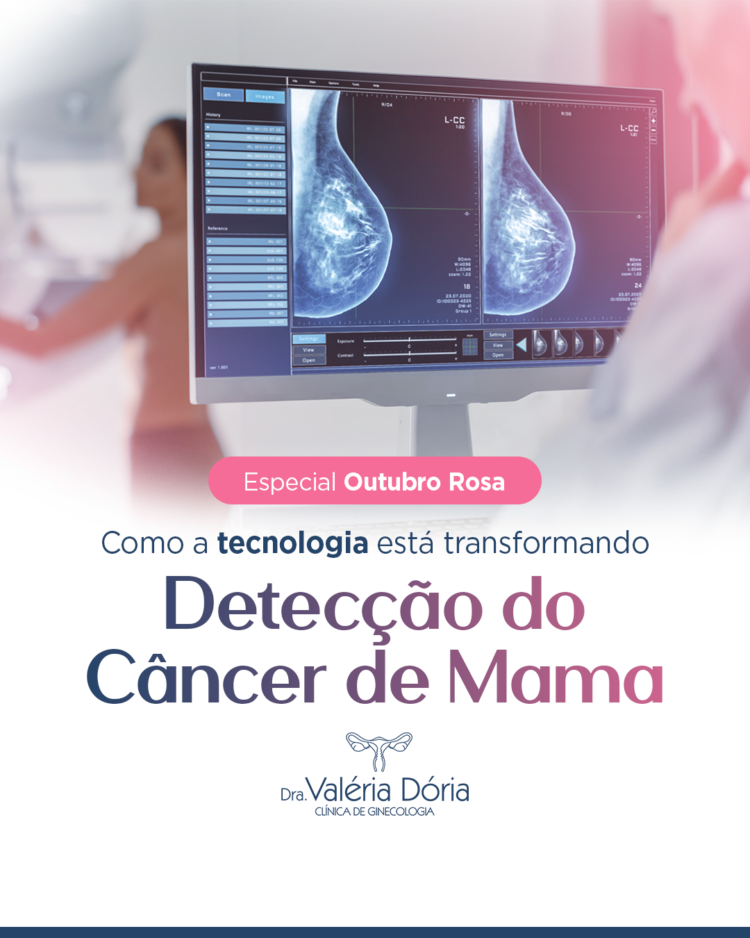 Como a tecnologia está transformando a detecção do Câncer de Mama