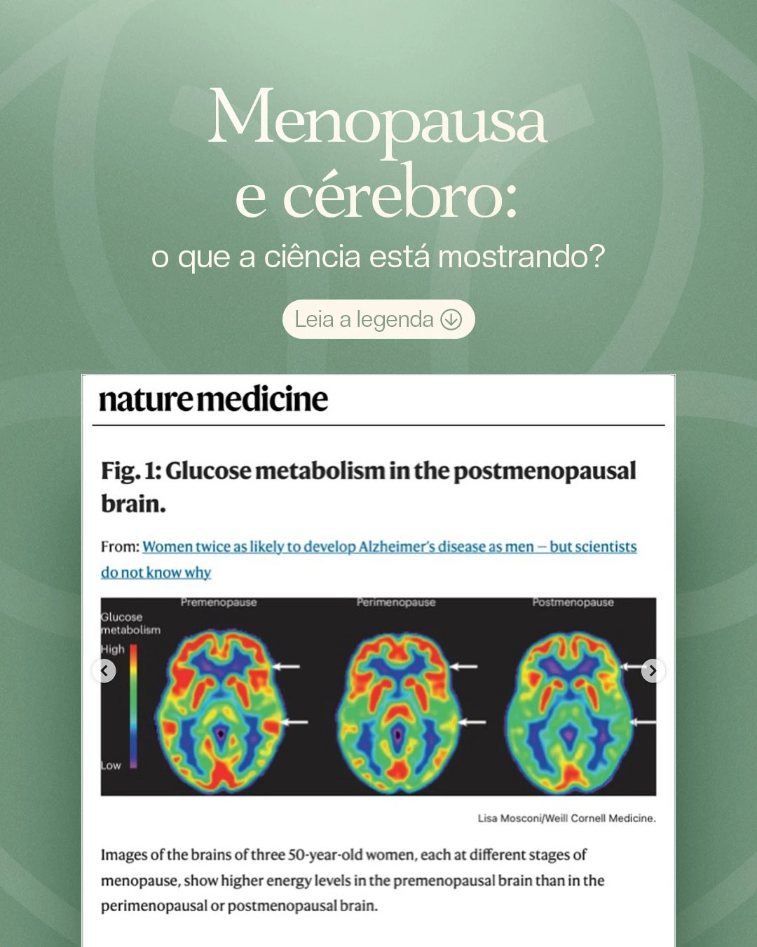 Menopausa e cérebro: o que a ciência está mostrando?